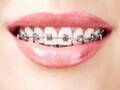 Dr. Cora Haller-Waschak, Fachärztin für Zahn-, Mund- und Kieferheilkunde